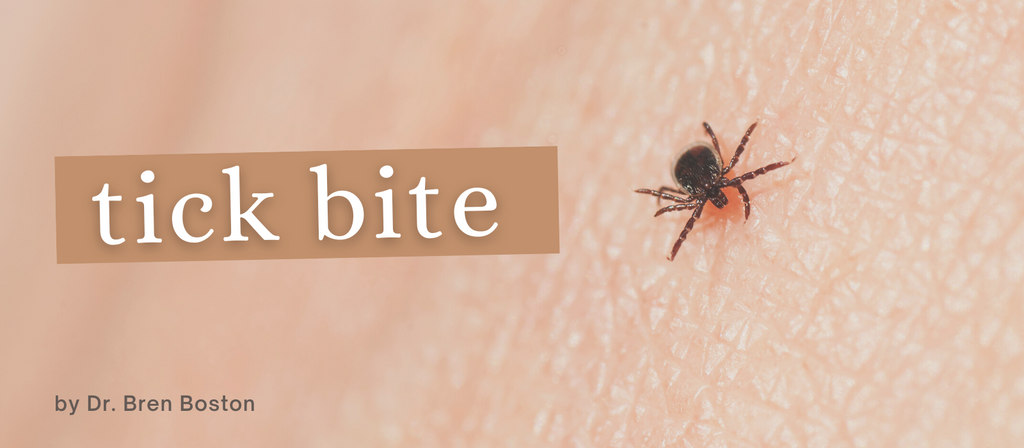 Tick Bite - I just found a tick! Do I have to worry about Lyme disease?